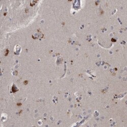 KLHDC3 Antibody, Novus Biologicals:Antibodies:Primary Antibodies